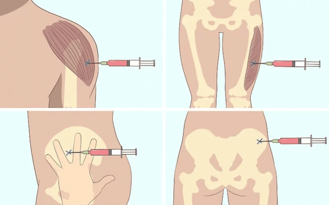 B12 Injection Kits vs. Professional B12 Injections: Weighing the Pros and Cons