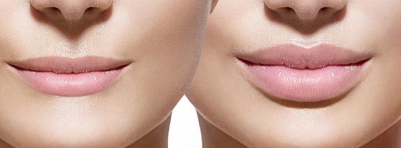 natural lip enhancer