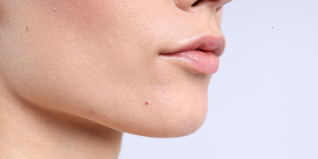 Understanding the BioFiller and PRF Difference