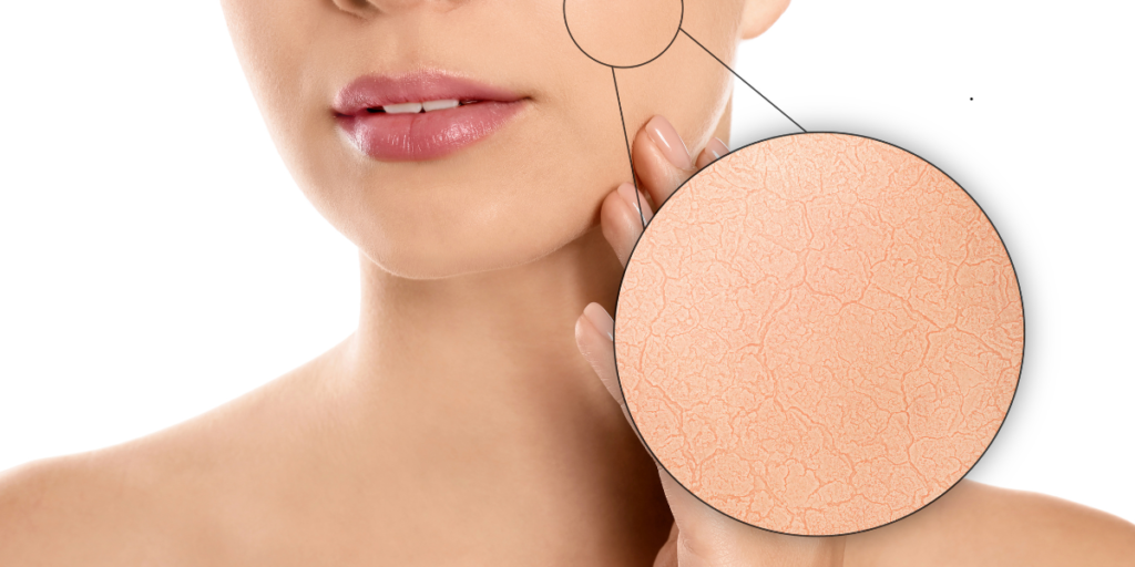 What Makes the Cheeks Ideal for Regenerative Treatment